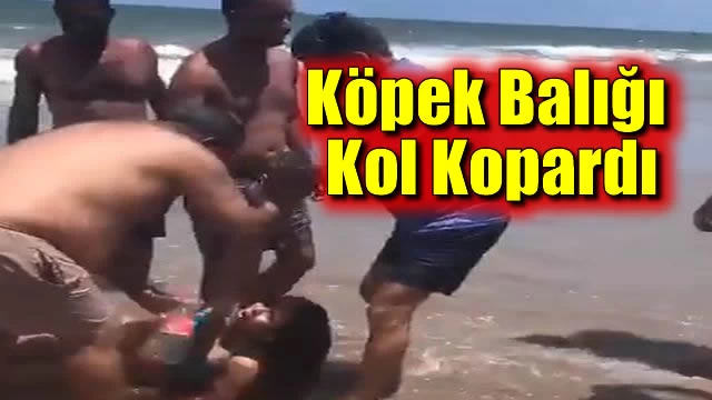 Köpek Balığı Kol Kopardı