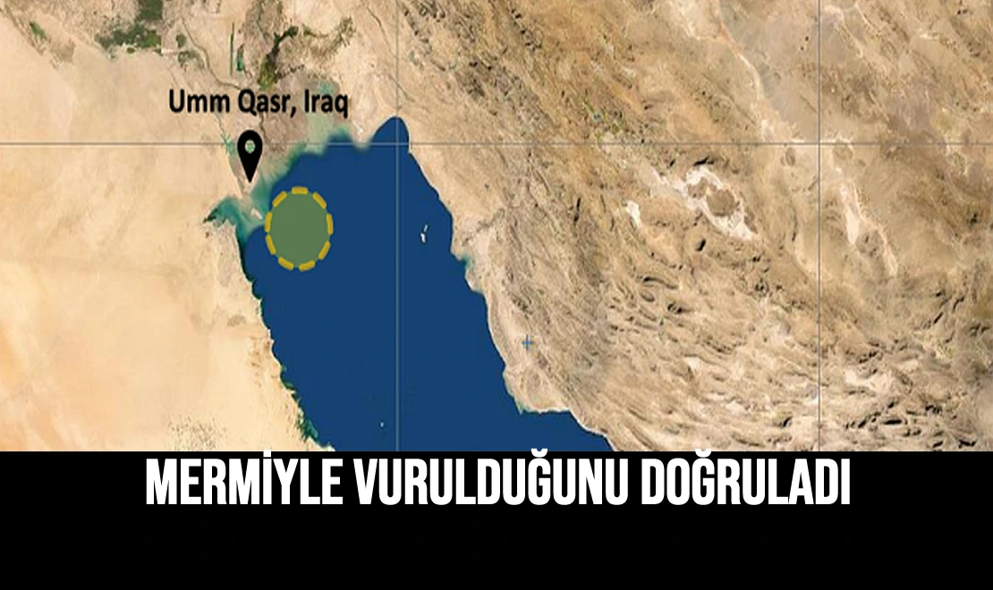 Mermiyle Vurulduğunu Doğruladı