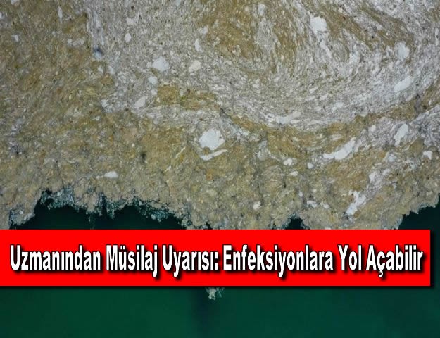 Uzmanından Müsilaj Uyarısı: Enfeksiyonlara Yol Açabilir