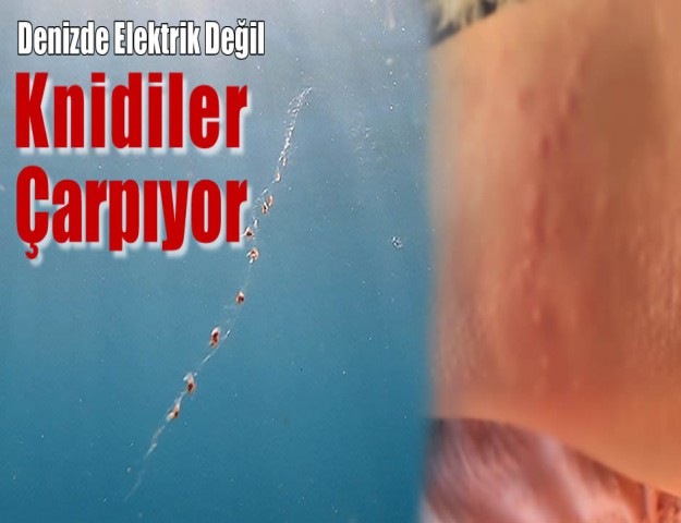Denizde Elektrik Değil Knidiler Çarpıyor